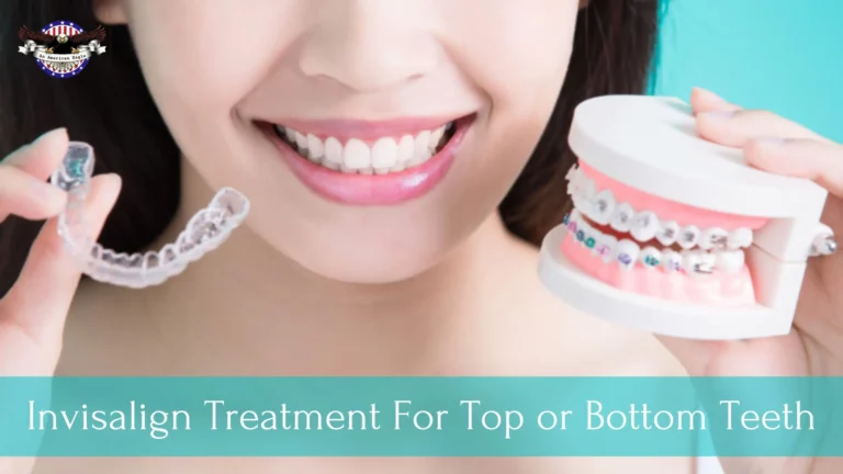 Get Invisalign Treatment For Top or Bottom Teeth
