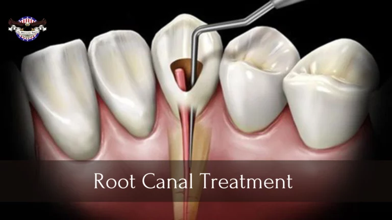 Root Canal Treatment Versus Tooth Extraction – Which You Should Choose